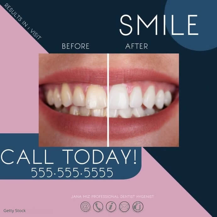 dentist before after ad design template 66eb279725f65e1b3c01bce19672c6ac screen - This Is Why Your Facebook Ad ROI Sucks